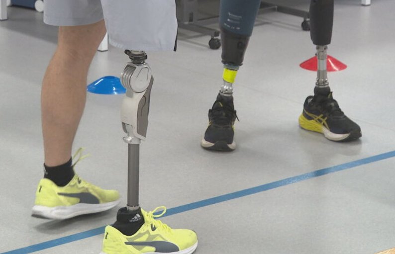 У Києві запустили безкоштовну програму протезування для військових і цивільних, які постраждали від війни